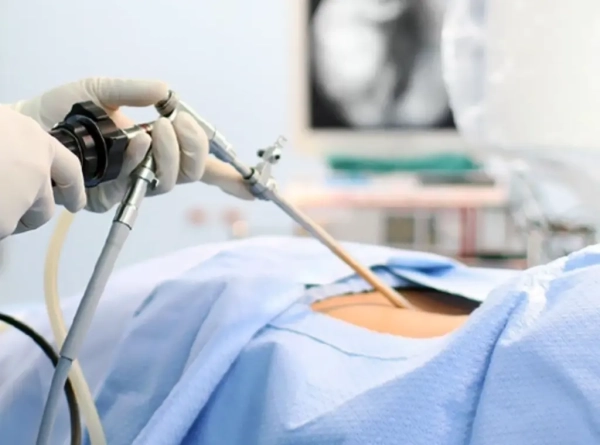 What is Robotic Surgery?